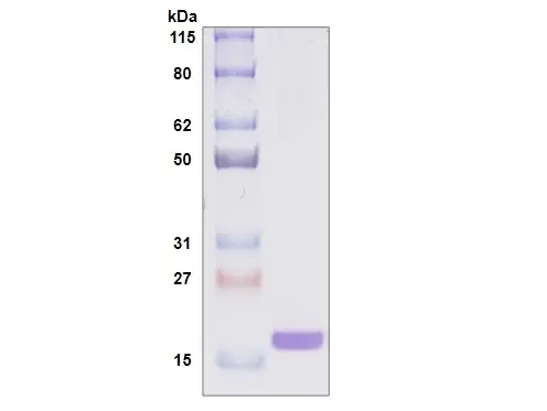 Recombinant Human Galectin 7, His Tag -25 ug